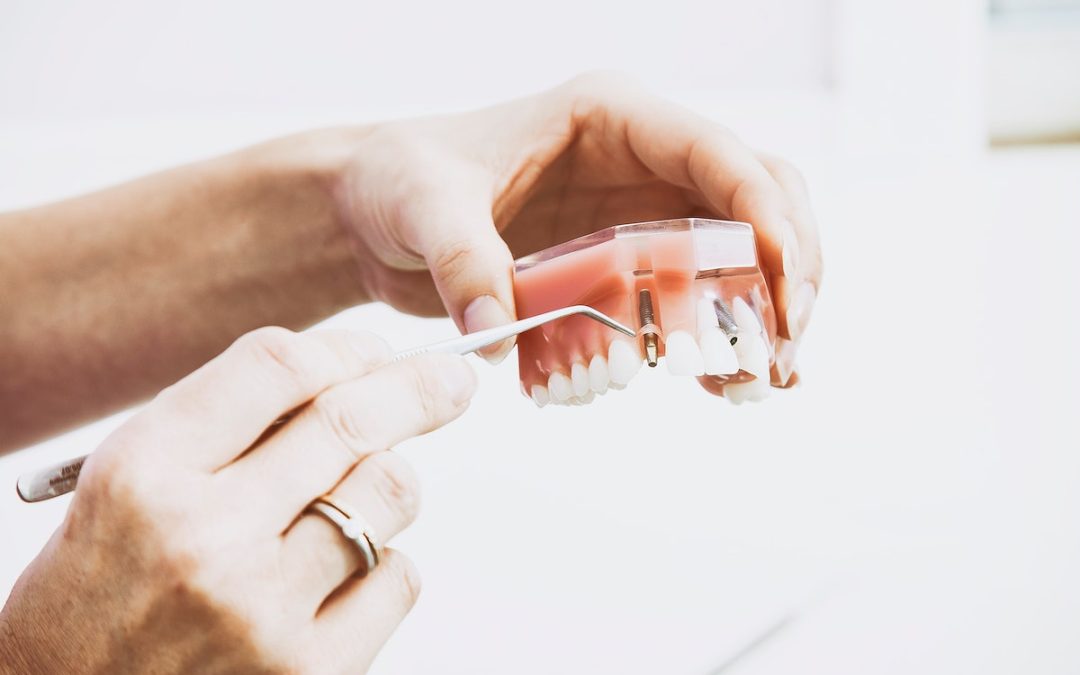 Experience Renewed Confidence with All-On-4 Dental Implants in Buford, GA